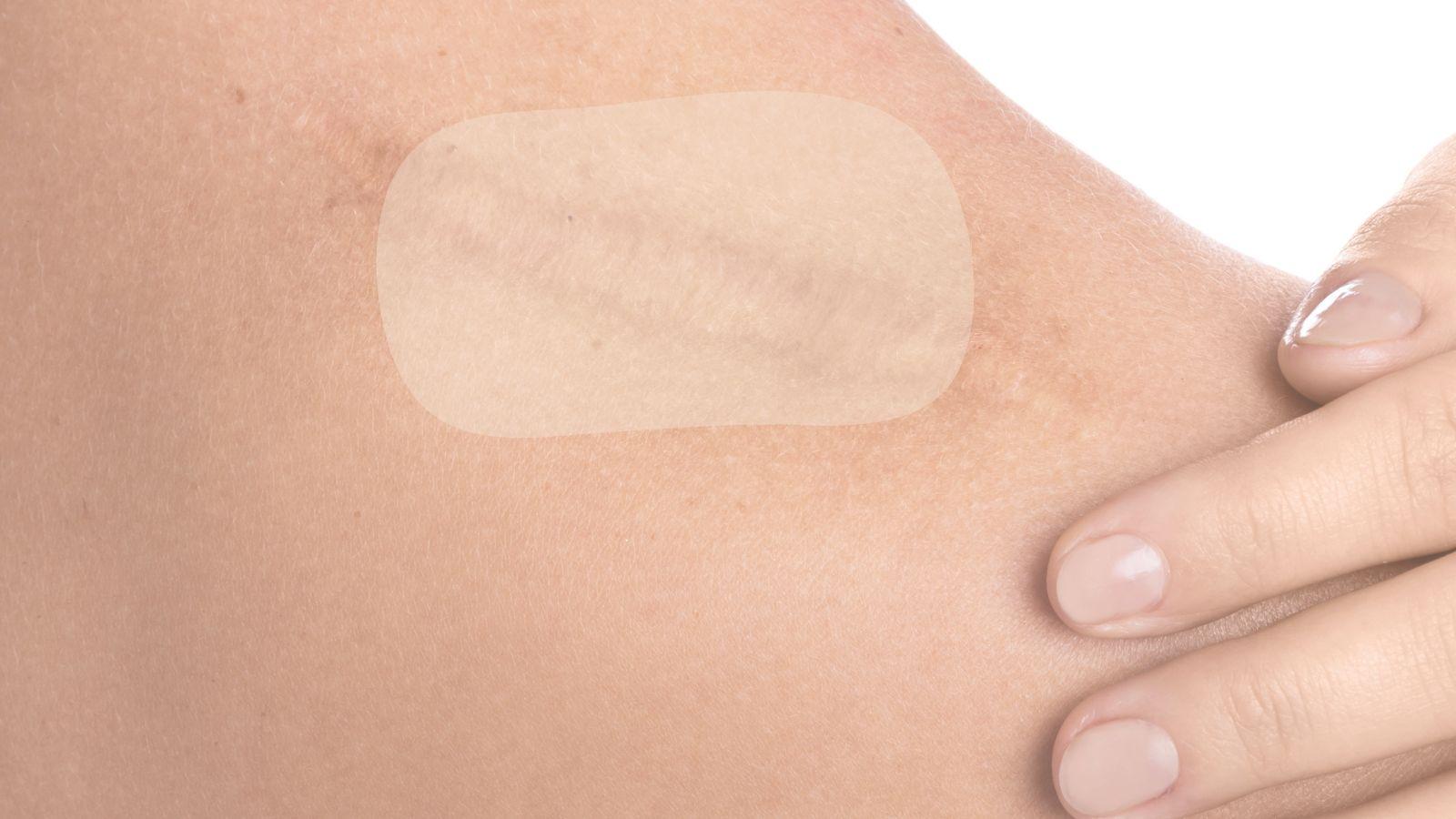 vetiver essential oil helps with scars image of a scar covered up with a plaster on skin